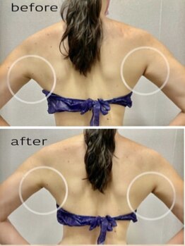 エンチャント(ENCHANT)/脇のお肉もスッキリ！