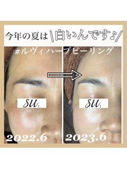 スー(su:)/夏のお疲れ肌にもハーブは最適！