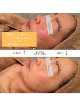 カオヤ プラス(Kaoya plus)/エンビロン無料カウンセリング◎