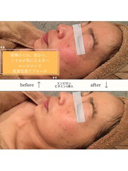 カオヤ プラス(Kaoya plus)/エンビロン無料カウンセリング◎