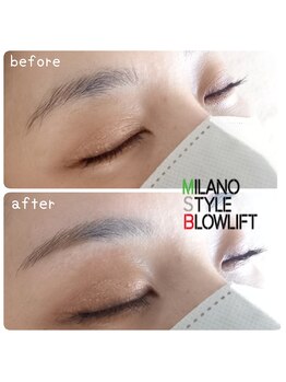 シャルマン(charmant)/ミラノスタイルブロウリフト