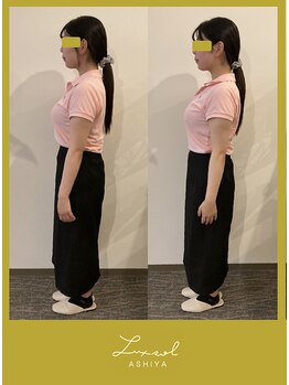 ルク ソル(Luxsol)/猫背　巻き肩　肩こり