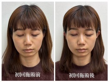 トータルバランス整体院 &nbsp;オレンジ(ORANGE)/小顔矯正/食いしばり/顔の左右差