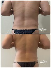 エルール トータルビューティ(Aileure total beauty)/インディバ×アミノ酸