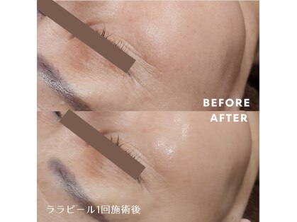 脱毛サロン ベル(Bell)の写真