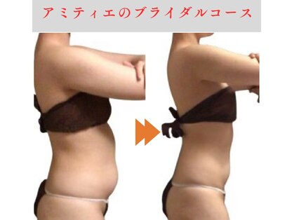 アミティエ(AMITIE)の写真