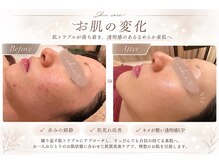 イーネ オランジェ 立川店の雰囲気（大人気クリスティーナ★）