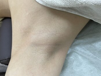 ナノハナ/鹿沼市の全身脱毛美容室ナノハナ