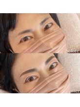 ダリ(Dali)/ハリウッドブロウリフト