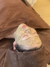 レブ(rev)/ハーブピーリング