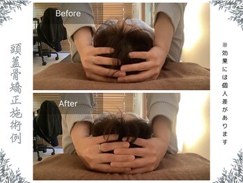 ボディ リセット アンド デザイン(Body Reset & Design)/【施術例】ビフォーアフター