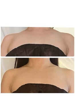 チャーム(Charm)/全身痩身