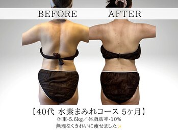 ヨサパーク ククナ 大塚(YOSA PARK kukuna)/痩身/ダイエット/よもぎ蒸し痩身