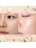 ☆新メニュー☆ 韓国艶美肌 水光生美容液導入MTSトリートメント