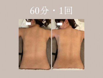 ハネ 自由が丘(Hane)/[自由が丘/インディバ/術後ケア]