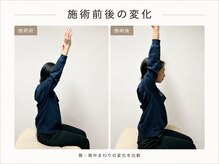 テラス 千葉(TERAS)/肩こりで来店/20代女性の変化