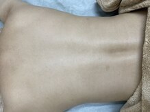 ナノハナ/鹿沼市の全身脱毛美容室ナノハナ