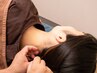【気になる部位に】上半身鍼灸　施術時間30分
