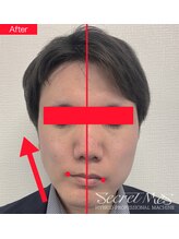 ヴェリー(VARY)/最先端エステマシンが使い放題