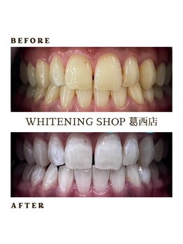 ホワイトニングショップ 葛西店/歯科提携 ホワイトニング専門店