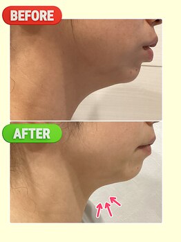 フォーユー 飯能店(Foryou)/レモンボトル効果抜群