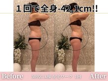 アメリイ 百合ヶ丘 新百合ヶ丘(Amerii)/【痩身】1回全身-42.1センチ痩せ