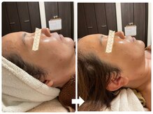 サロン ド ジョワ(salon de joie)/リフトアップで小顔美人