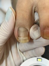 リネイル 長浜(Re-na-iL)/ネイルケア＆スパ¥7000