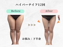 美容整体ウェリナ あま甚目寺院/小顔矯正/骨盤矯正/美脚サロン