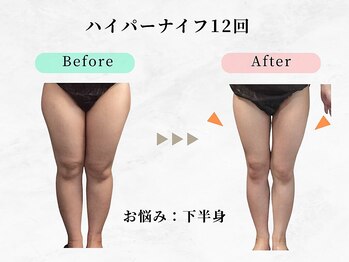 美容整体ウェリナ あま甚目寺院/小顔矯正/骨盤矯正/美脚サロン