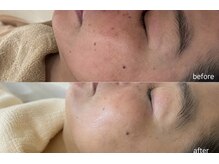 エーサロン(A-Salon)の雰囲気（【実績】シワ・シミ・たるみ・ニキビ・多数の改善例ございます）