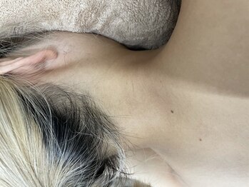 ナノハナ/鹿沼市の全身脱毛美容室ナノハナ