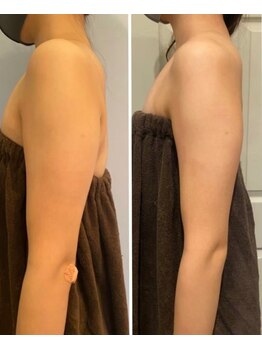 ルナグランデ(Luna grande.)/二の腕引き締めもできます!