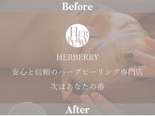 ハーバリー ハーブピーリング 金山店(HERBERRYハーブピーリング)/ハーブピーリング専門店HERBERRY