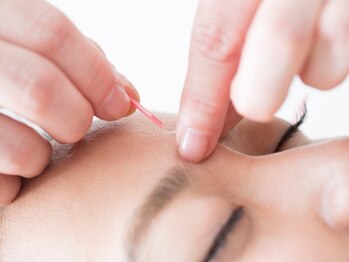 いなほ はりきゅう整骨院 東新宿/美容鍼コース