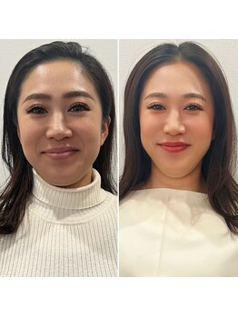 ラ ヴェリーテ(La Verite)/カラードレープ診断