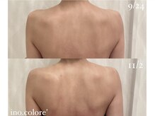 リノコロレ(ino.colore')の雰囲気（背中や頭から小顔に導きます【フォトギャラリーをご覧下さい】）