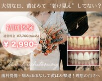 マインリー(Minely)