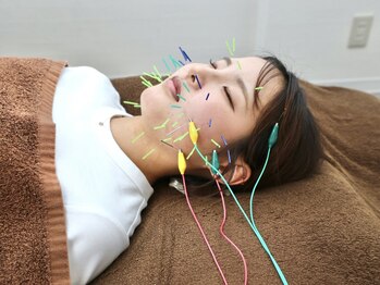 鍼灸整骨院ひでの写真/【早期効果実感】美容鍼+電気を流し筋膜から食い縛り・たるみ・ほうれい線改善で美しいフェイスラインへ◇