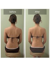 エミニー(EMINY)/