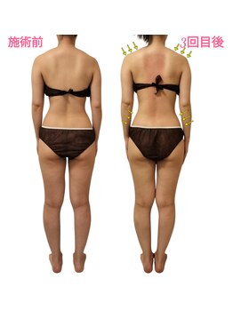 リリー(liLy)/チノザメソッド★ラグジュアリー