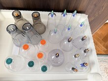 スイクウ ネオ(neo)/豊富なカッピングの種類