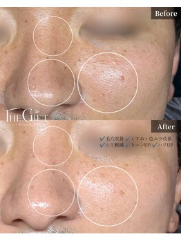 ザ ギフト 栄(The Gift)の写真/美容看護師による本気の肌管理で理想の素肌へ【トロイアルケ】