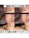 スリーム(S-urimu)の写真/【フォト婚でも写真映えをお約束】華奢な二の腕×フェイスラインくっきり小顔☆マシン10種カスタマイズ☆