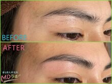 エムディラボ 富山新根塚店(MDラボ)/before after