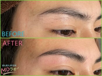 エムディラボ 富山新根塚店(MDラボ)/before after