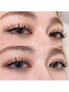 アーラ(Alas)/フラットラッシュ　つけ放題