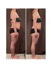 フォーリーフ クローバー(Four Leaf Clover)/筋膜リリース進化版"Mリリース”