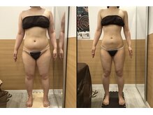 リッツ 草加店(Ritz)/【Before/After】痩身