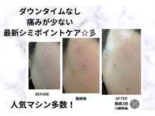 ルアナ(Ruana)の雰囲気（ダウンタイムなしのシミソニック・毛穴/小顔/美白）